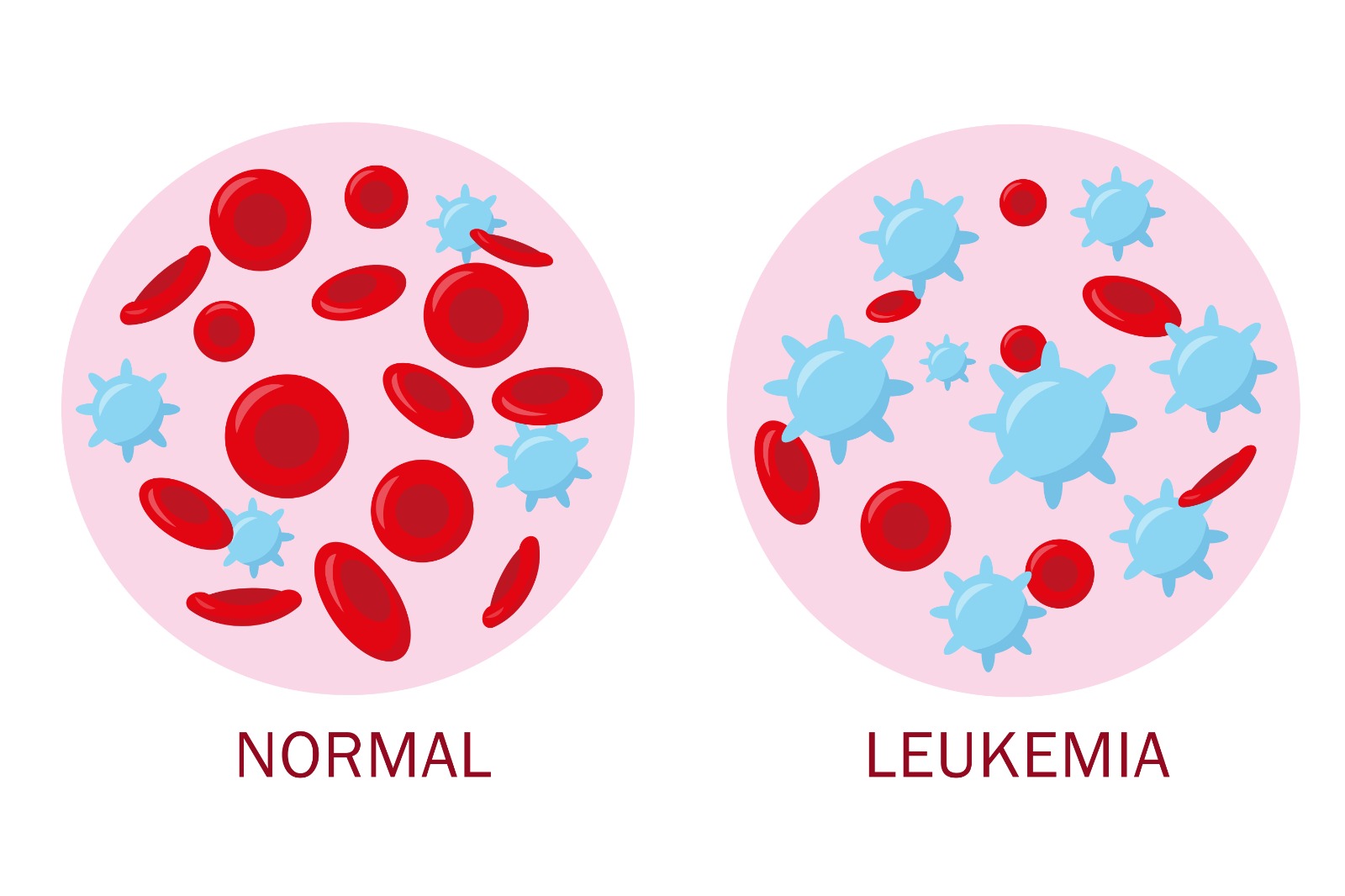 What is chronic myeloid leukemia.jpeg