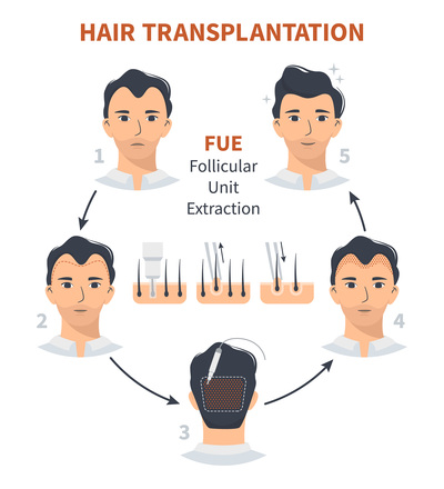 fue-transplant-in-turkey.jpg